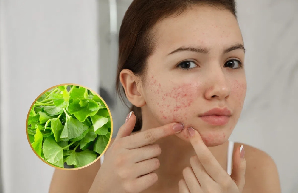 Rau má hỗ trợ điều trị các bệnh về da như chàm, vảy nến