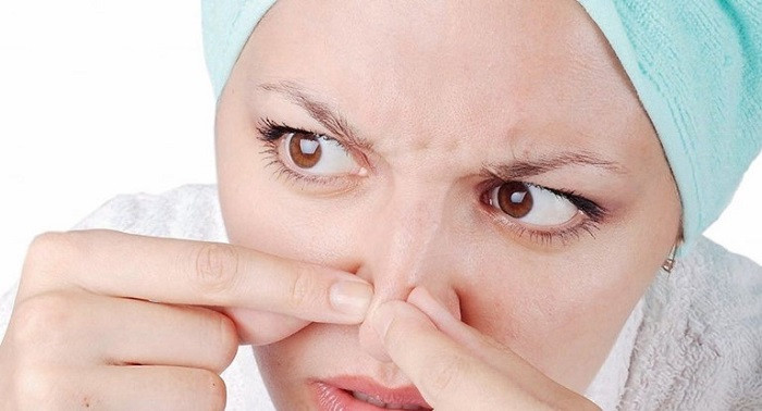 TOP 7 Cách trị mụn cám hiệu quả cho mọi loại da