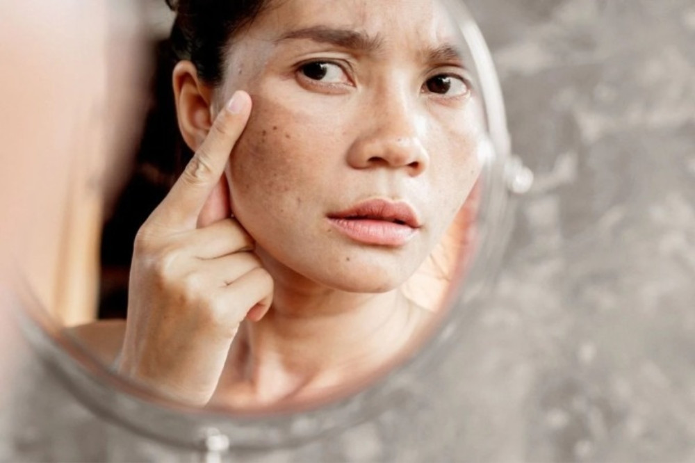 Sử dụng kem chống nắng bị vón cục có thể gây hại cho da