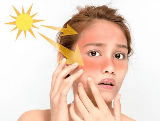 Sử dụng kem dưỡng ẩm giúp bảo vệ da khỏi tia UV có hại từ ánh nắng mặt trời