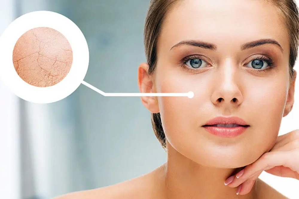 Tại sao cần cấp nước cho da khô?