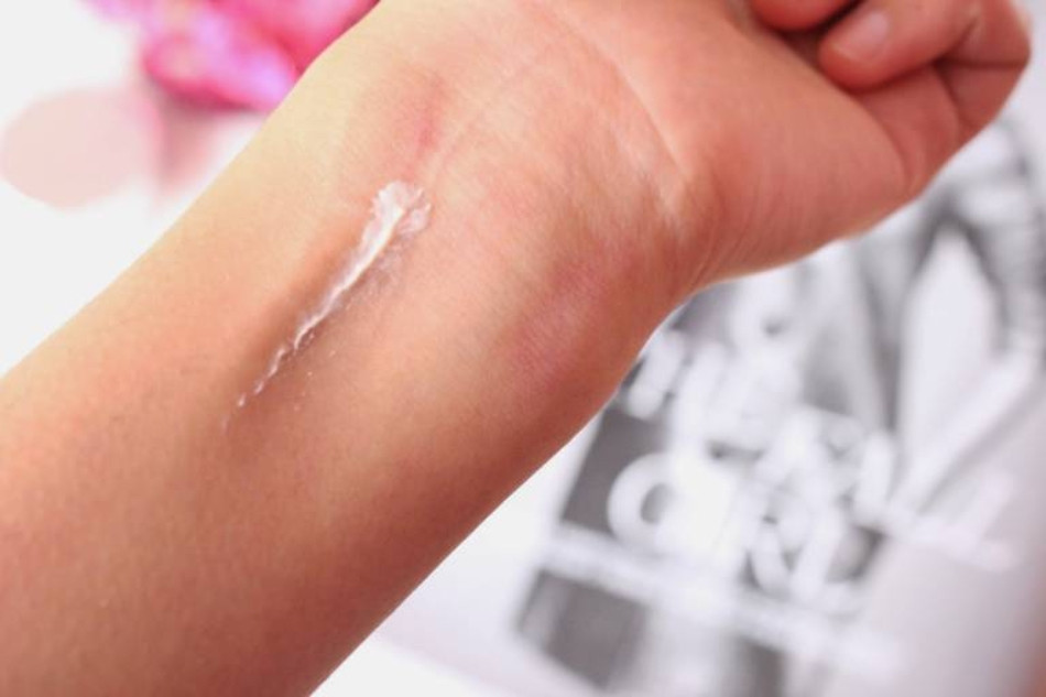 Thử nghiệm trên một vùng da nhỏ trước khi áp dụng cho toàn mặt