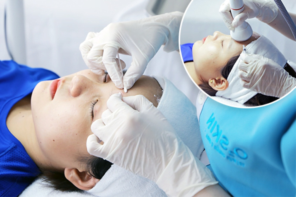 Thực hiện điện di và lấy nhân mụn tại các cơ sở da liễu uy tín