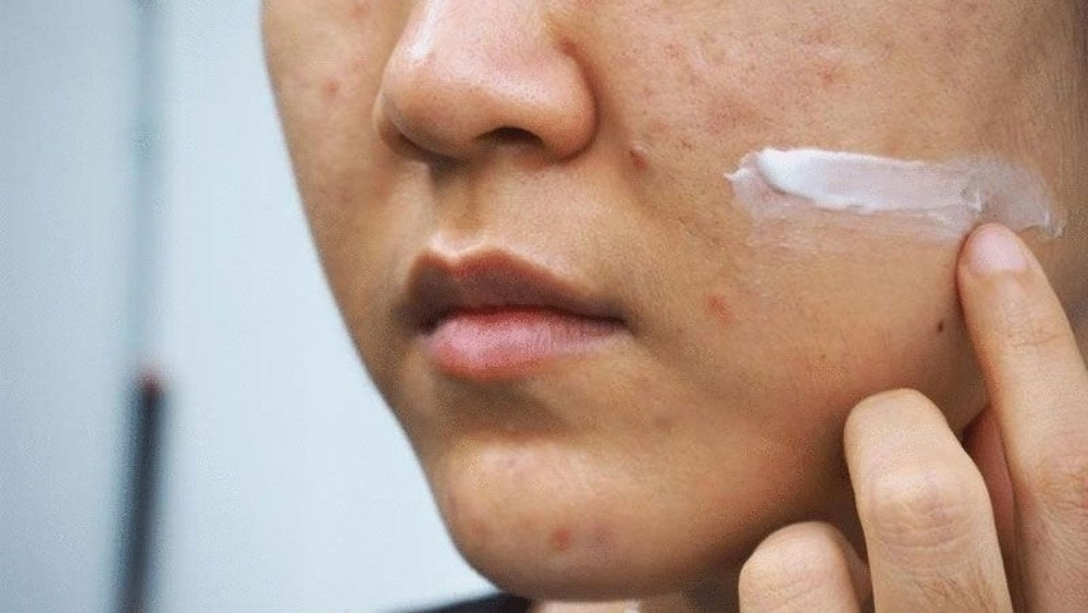Thuốc hỗ trợ làm lành vết thương