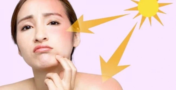 Tia UV gây tổn thương da