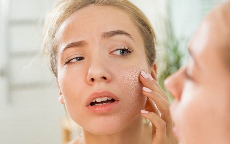 Tìm hiểu nguyên nhân gây khô da và lỗ chân lông to
