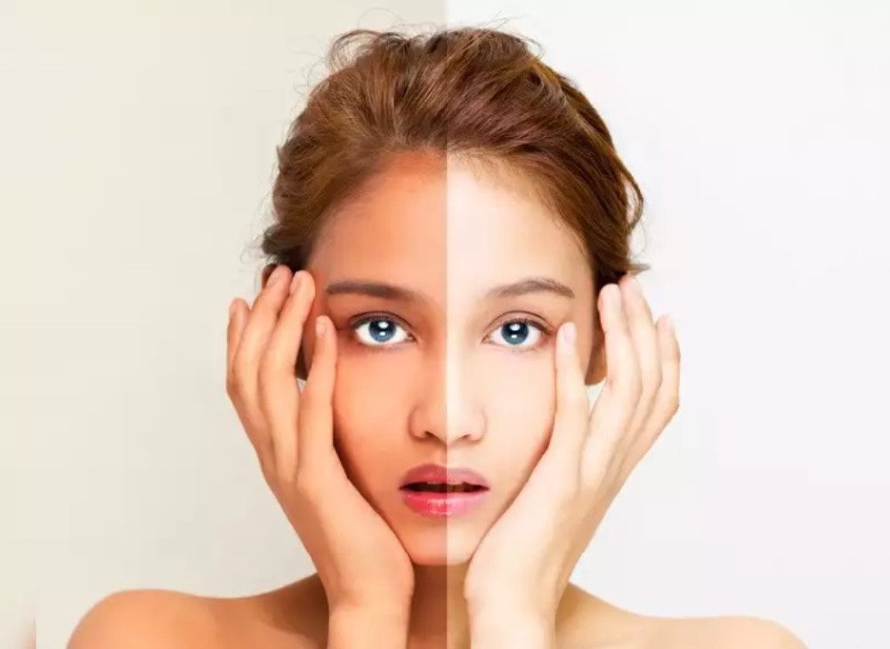 15 Cách Chăm Sóc Da Bị Cháy Nắng Hiệu Quả