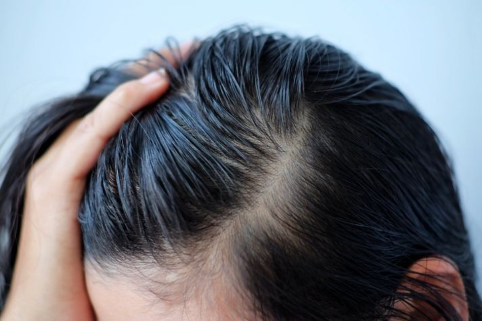 Gợi ý 17 dầu gội cho tóc bết suôn mượt, bồng bềnh ngay lập tức