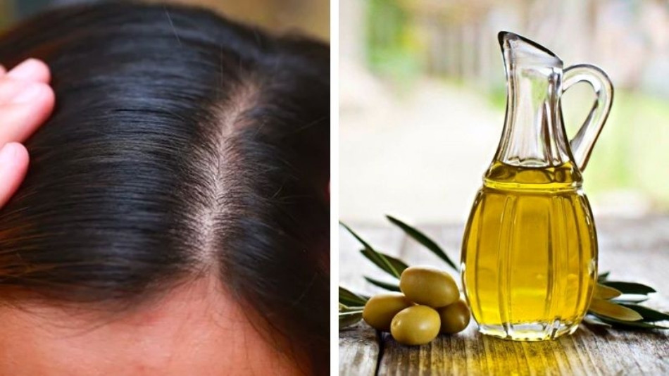 Trị gàu với dầu oliu