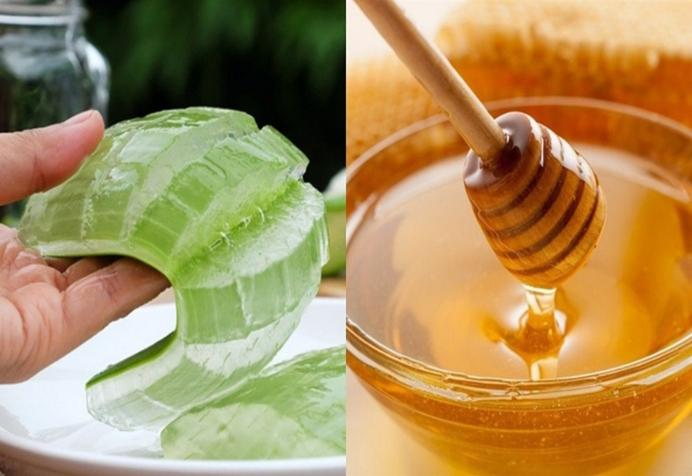 Trị mụn với mật ong và nha đam