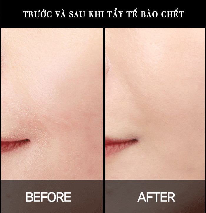 Trước và sau khi tẩy tế bào chết cho da