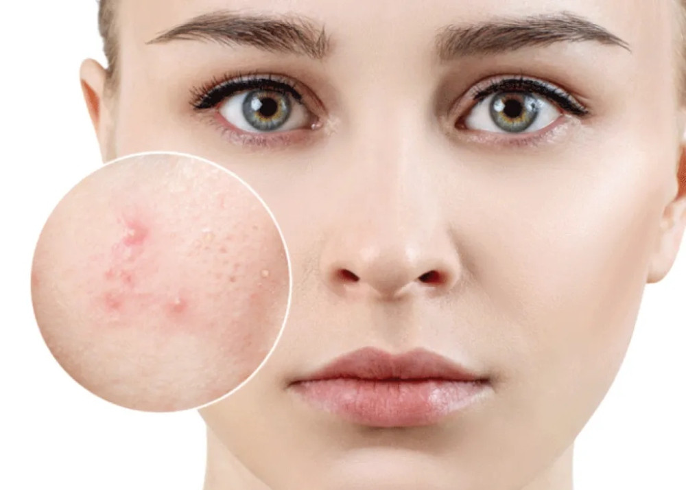 Tuân thủ các bước chăm sóc da giúp duy trì làn da khỏe mạnh