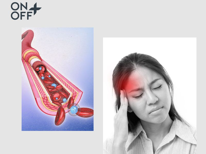 Việc mặc áo ngực không phù hợp khi ngủ có thể gây cản trở tuần hoàn máu