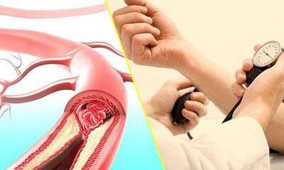 Vitamin C giảm nguy cơ bệnh huyết áp