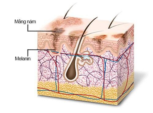 Vitamin C ức chế Melanin