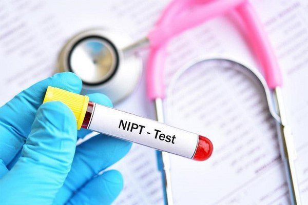 Xét nghiệm NIPT Monosomy X 60% khi mang thai 12 tuần có sao không?